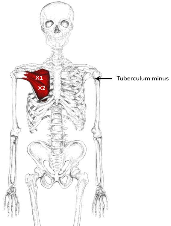 Subscapularis muscle pain & trigger points.