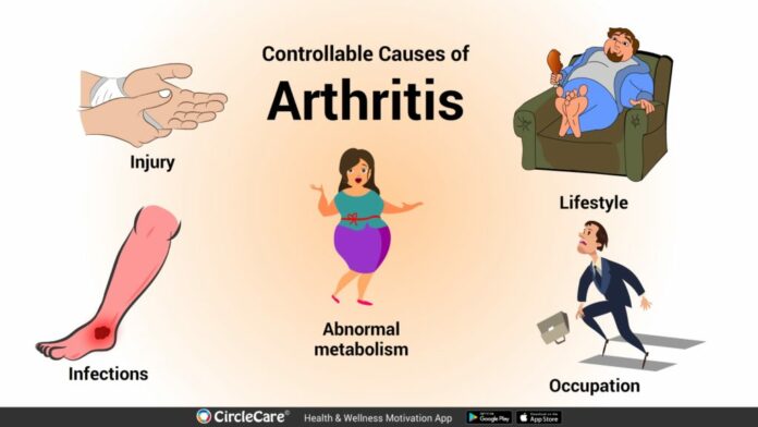 What is the fastest way to cure arthritis?
