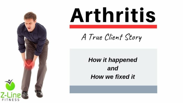 How long does an arthritis flare last?