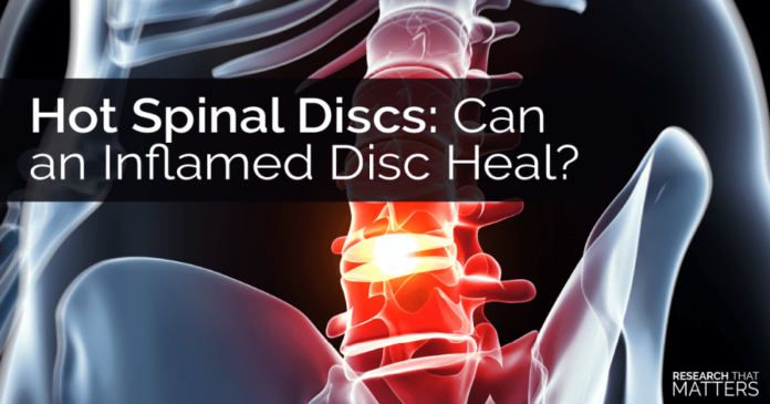 Why is it taking so long for my herniated disc to heal?