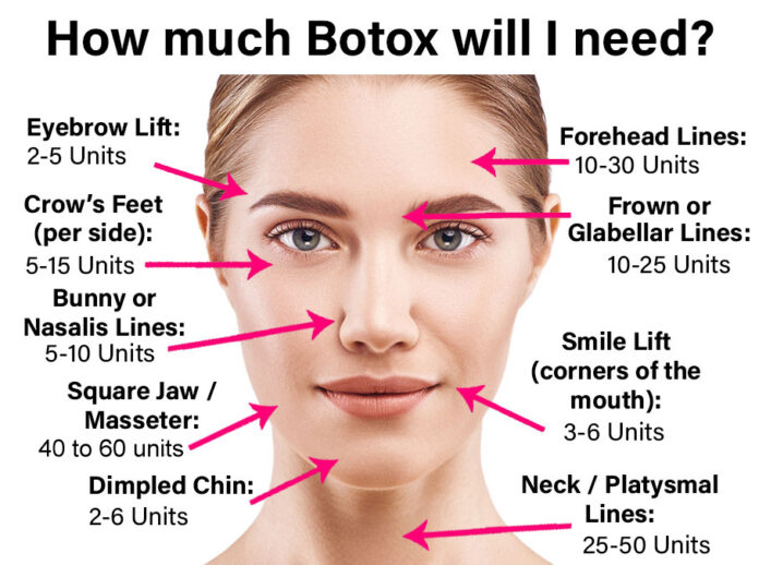 Do and don'ts after Botox?