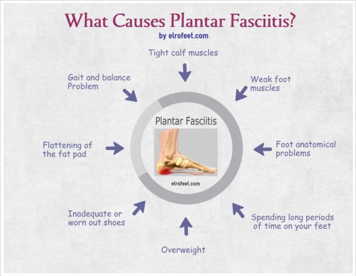 What is the root of fasciitis?