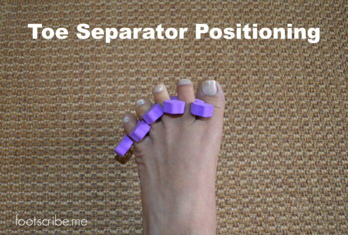 Are toe spreaders good for your feet?