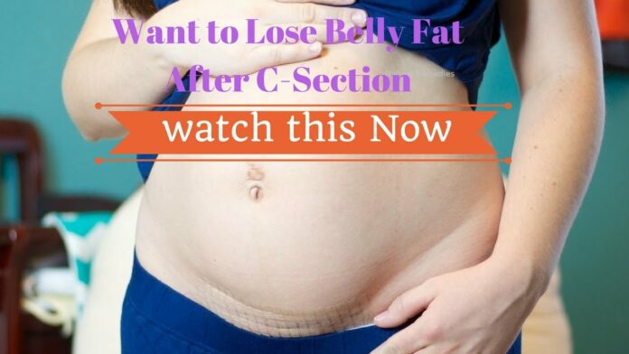When can I wear a belt after C-section?