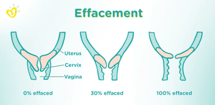 Can a cervix ripen overnight?