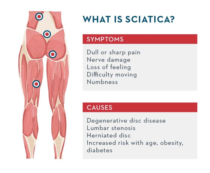 What will a hospital do for sciatic nerve pain?
