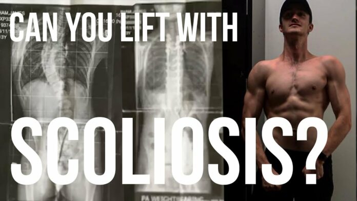 What can worsen scoliosis?