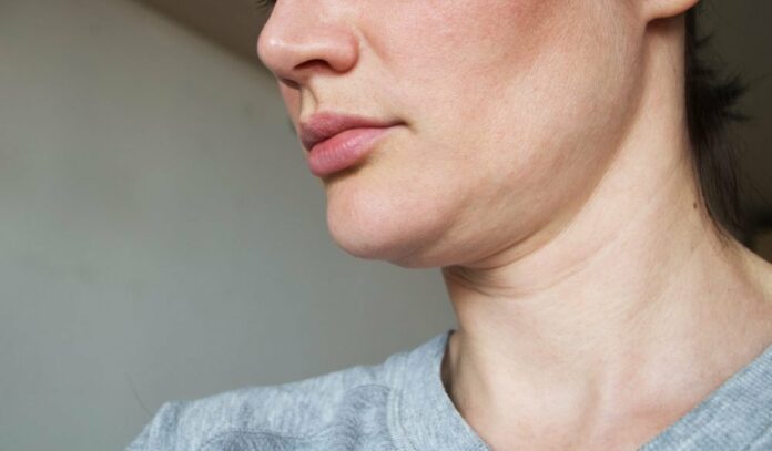 How do I get rid of the fat under my chin?
