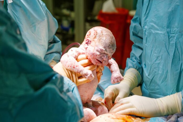 How can I avoid cesarean delivery?