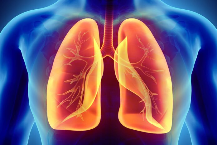 What does COVID-19 pneumonia cause?