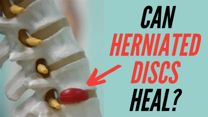 Can a herniated disc heal after 2 years?