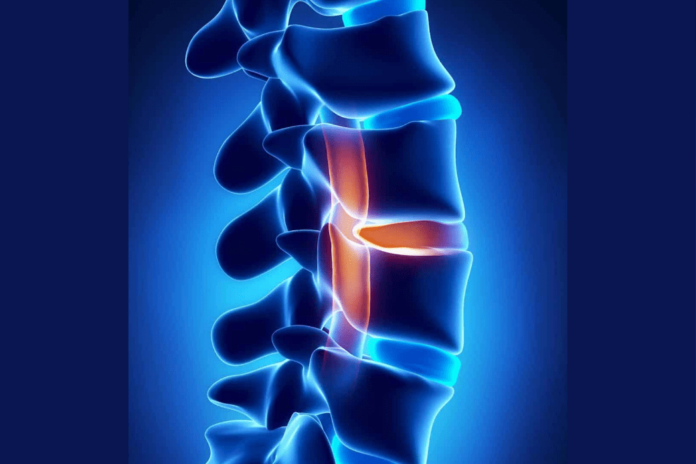 How do I know if my herniated disc is healing?