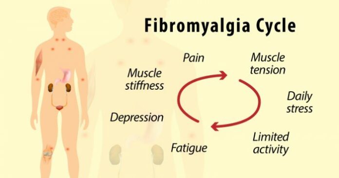 What is the most effective treatment for fibromyalgia?