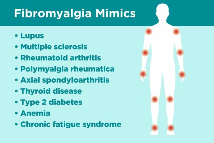 How serious is fibromyalgia?