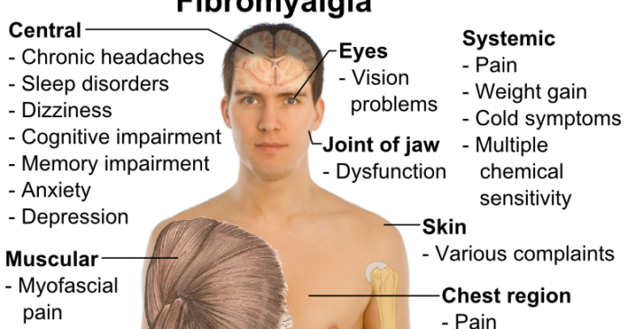 How do they test for fibromyalgia?