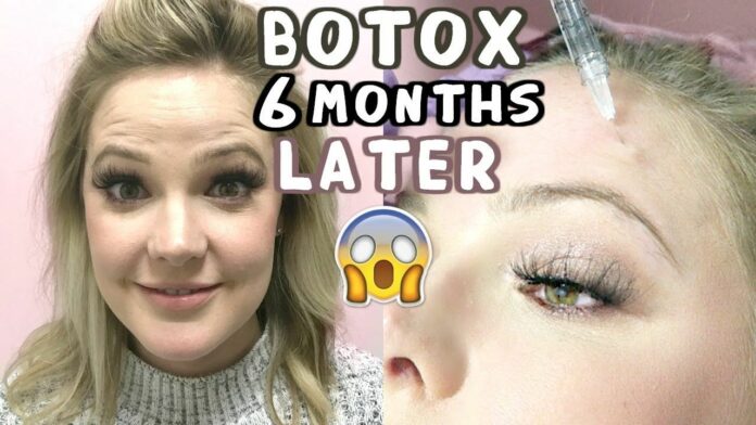 How much zinc should I take with Botox?