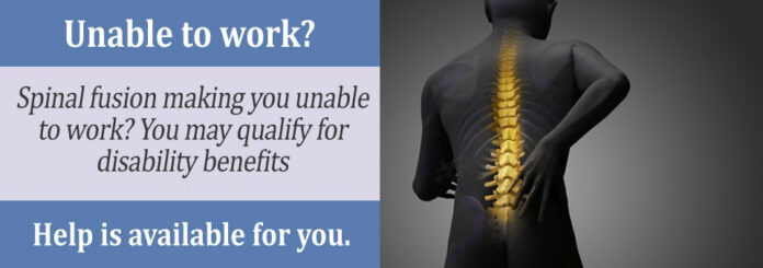 Why does my back hurt years after spinal fusion?