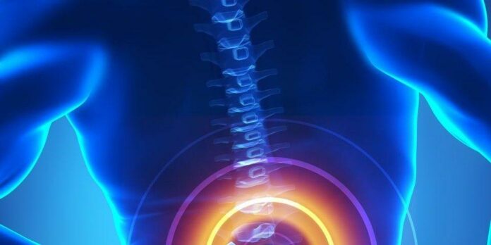Can you damage a spinal fusion?