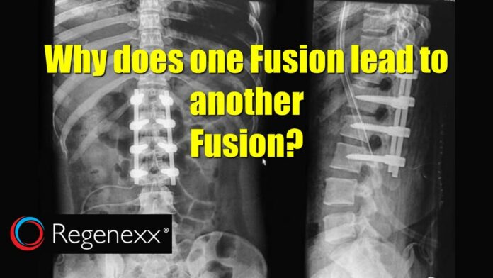 How do I know if my spinal fusion is healing?